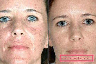 Miraculoarea facială miracle glow este o modalitate modernă