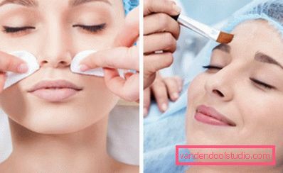 Peeling retinoic